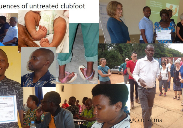 Healthcare officers Received Certificates On Treatment Of Clubfoot Deformity Healthcare officers Received Certificates On Treatment Of Clubfoot Deformity